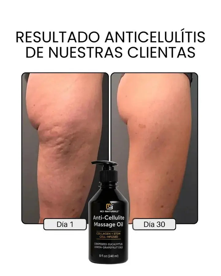 aceite anticelulitis + rodillo